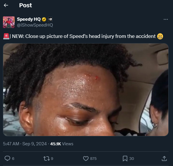 IShowSpeed's head injury after car crash in Thailand.