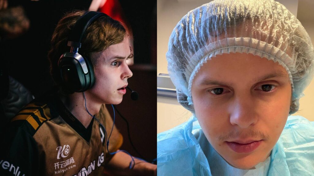 Former Dota 2 carry dyrachyo shares update after surgery, teases return to streaming games except Dota 2